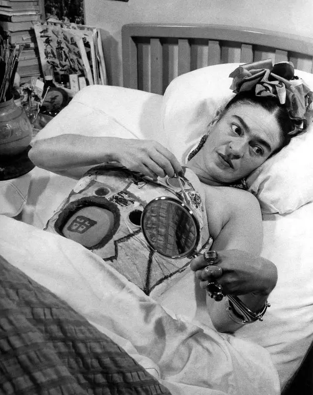Frida Kahlo's Recovery Journey at the Hospital Post-Bus Accident