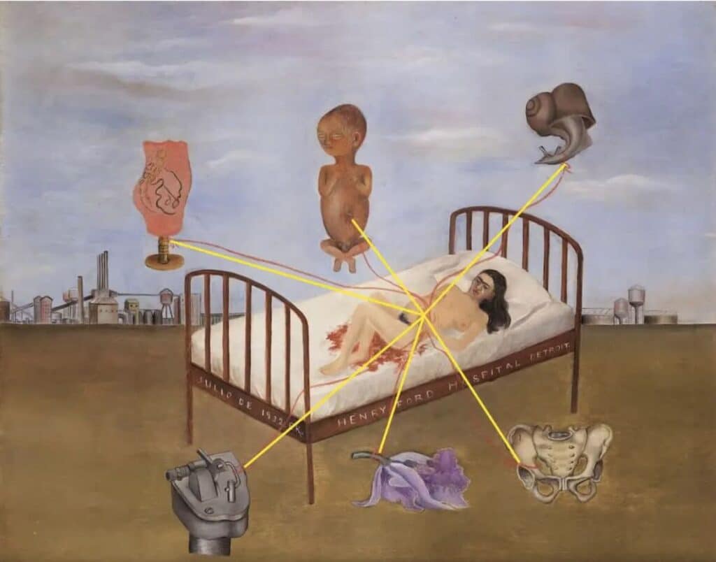 Henry Ford Hospital (1932) By Frida Kahlo